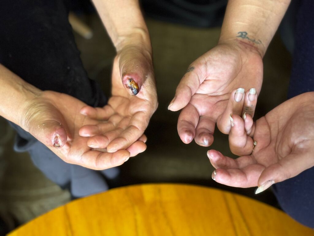 “A máquina seguiu, a nossa vida não”: acidentes de trabalho em São Marcos expõem dor, incertezas e fragilidade da segurança industrial